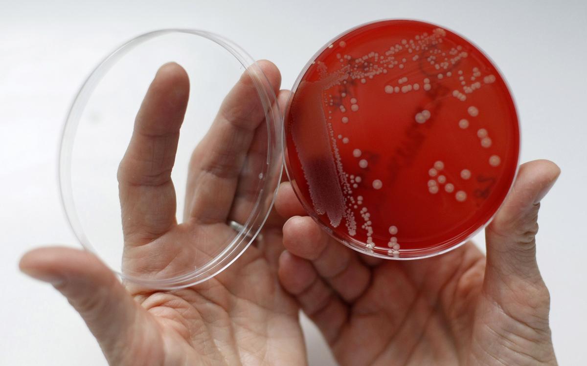 Responding to the Superbug Crisis