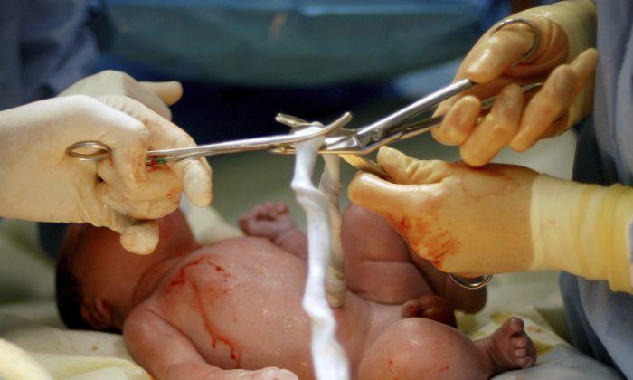 Delay Clamping Babies’ Umbilical Cords for Better Health and Development