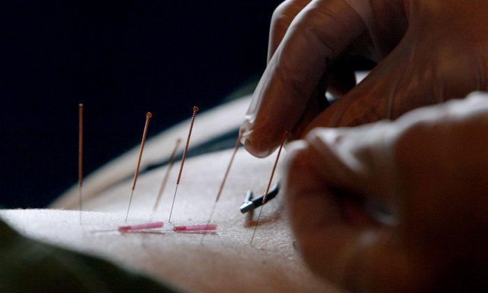 Now Acupuncture Proven a Powerful Anti-Inflammatory