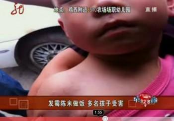 Moldy Rice Sickens 270 in North China Daycare
