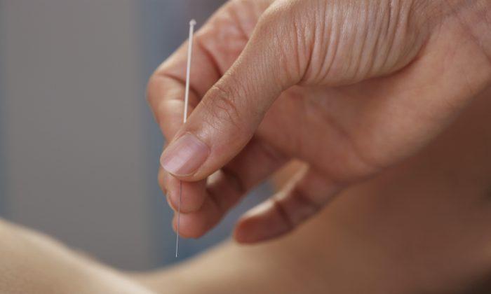 Stanford University: Acupuncture Reduces Pain After Surgery