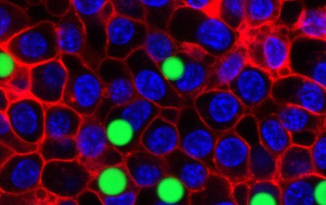 We Transformed Living Cells Into Tiny Lasers
