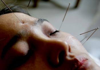 Acupuncture and Chinese Medicine for Mental Health, Part 1