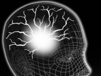 Magnetic Brain Stimulation May Aid Stroke Recovery