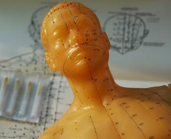 Acupuncture and Science Intertwined