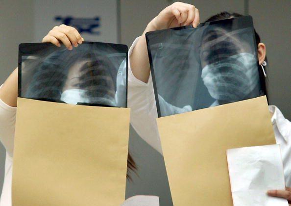 Students Contract Tuberculosis from Immunization in Hunan, China