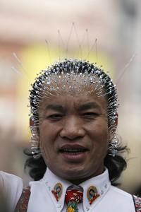 Guangxi Province Man Pokes 800 Needles Into Head