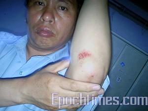 Beijing Christian Assaulted by Police