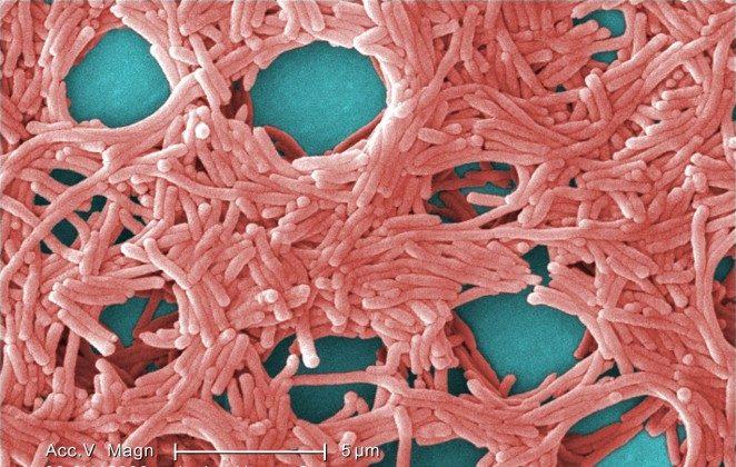 Officials: Legionella Bacteria Found in Water Supply at NYC Hospital
