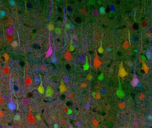 Brain cells or neurons like the ones shown here form a system of communication that acts like social networking. (AFP/Getty Images)