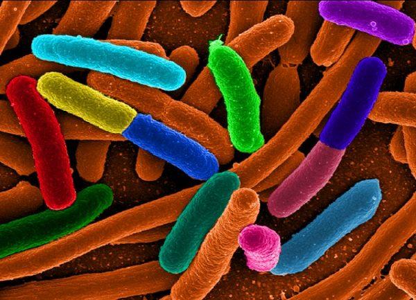 E. coli bacteria seen in different colors when exposed to ultraviolet light. (Mattosaurus/Wikimedia Commons)