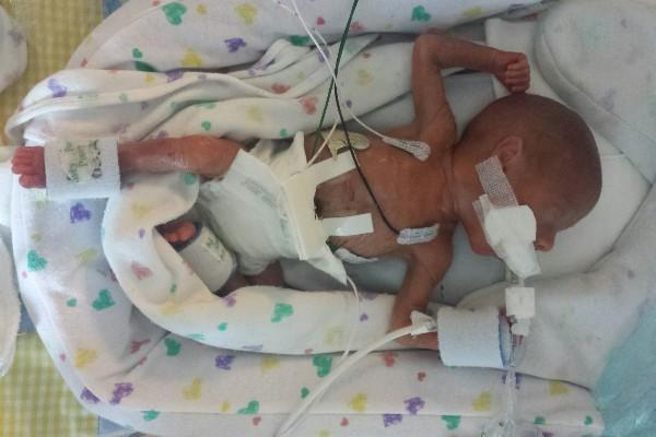 Identical Twin Brothers Will to Have Birthdays Months Apart Due to Rare Condition