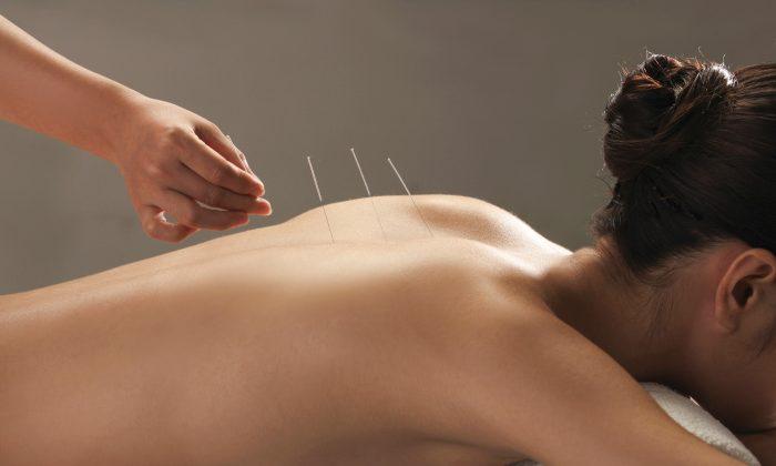 Finally, Acupuncture Proven to Reduce Pain
