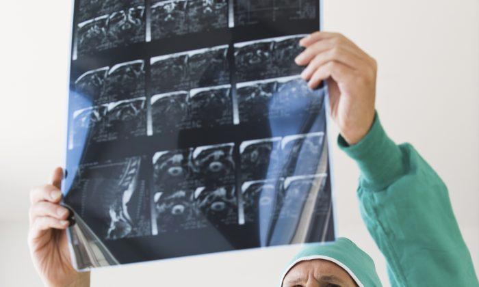 How to Avoid Misdiagnosis From Ultrasounds and MRIs