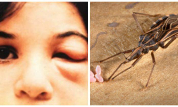How Deadly Are ‘Kissing Bugs’ Really?