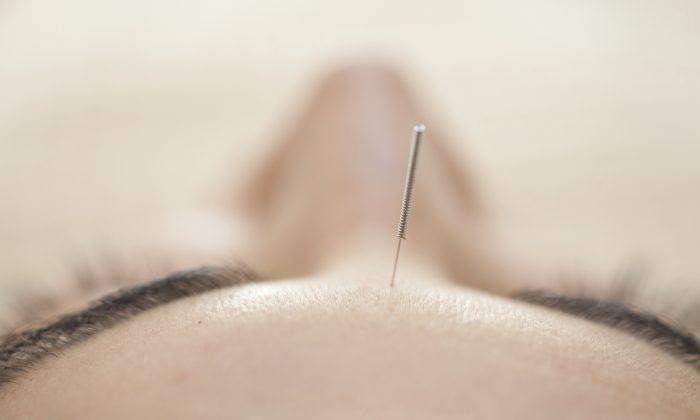 3 Great Reasons To Get Acupuncture This Winter