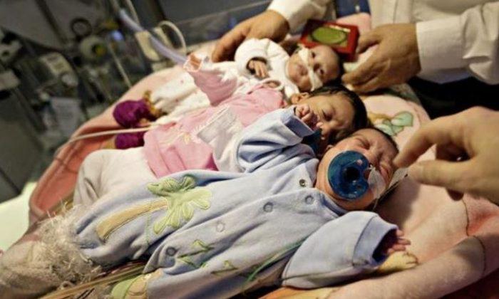 Youngest Ever Conjoined Twins Separated by Swiss Doctors at 8 Days Old
