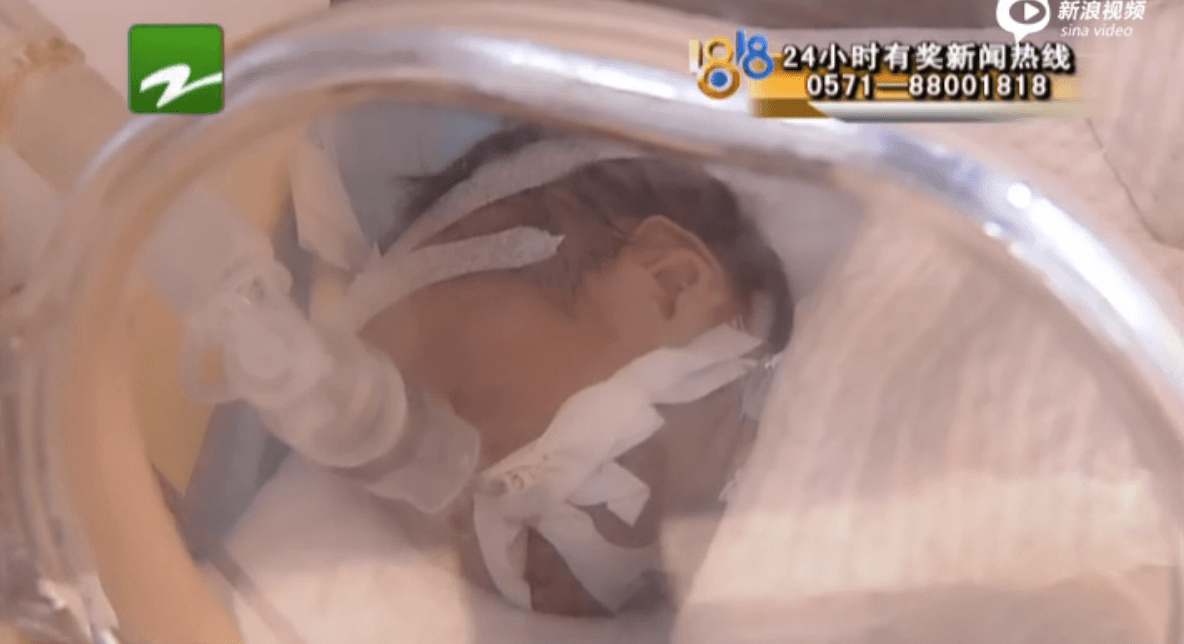 Baby Declared Dead by Chinese Hospital Wakes Up in Morgue