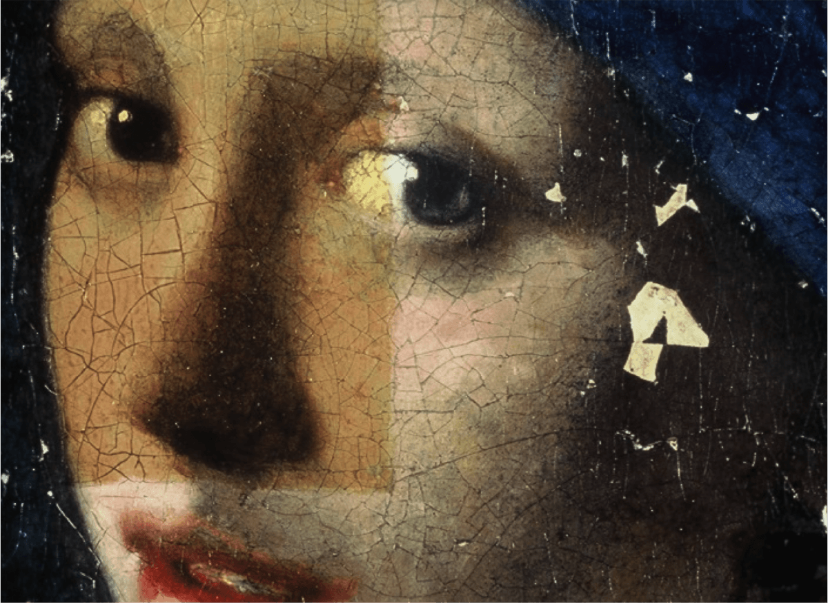  Fragment of the painting, "Girl with a Pearl Earring" showing the cleaning process during its restoration at the Mauritshuis, The Hague in 1994. (Courtesy of Jørgen Wadum)