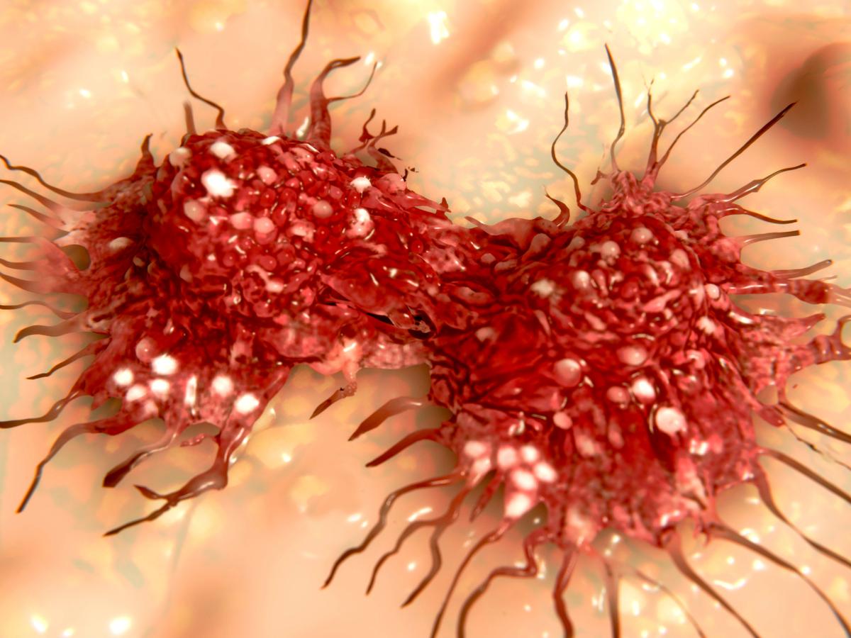 Better Than Chemo: Turmeric Kills Cancer Not Patients