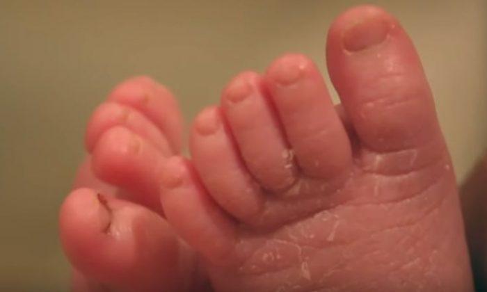 What Was Growing Inside This Newborn Was Something That Bewildered Doctors