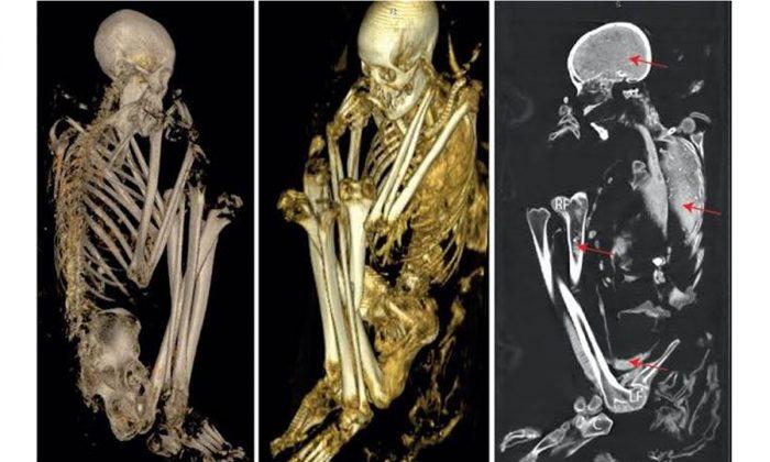 Scans and DNA Tests Reveal the Secrets of a Rare African Mummy