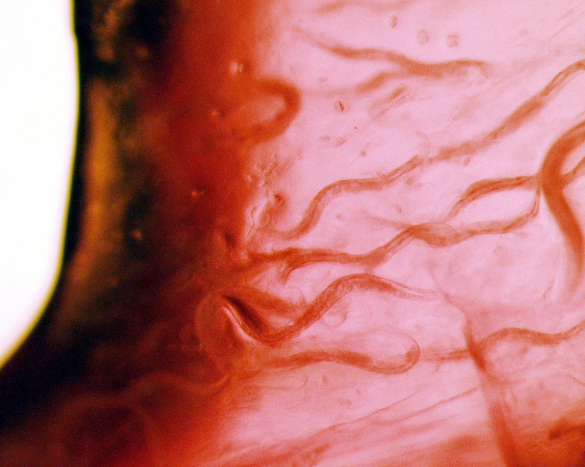 Top 4 Ways You Could Get a Parasite Infection