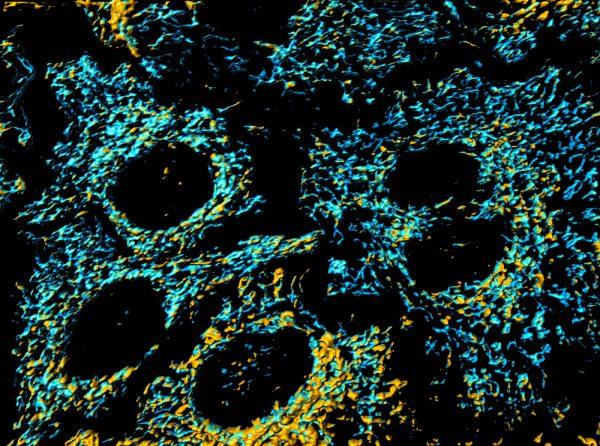 Mitochondria in HeLa cervical cancer cells. (photog/shutterstock)