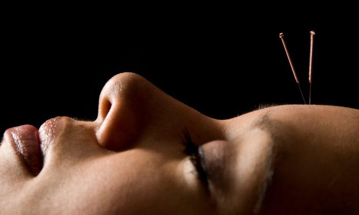 Acupuncture Pain Killing Mystery Revealed