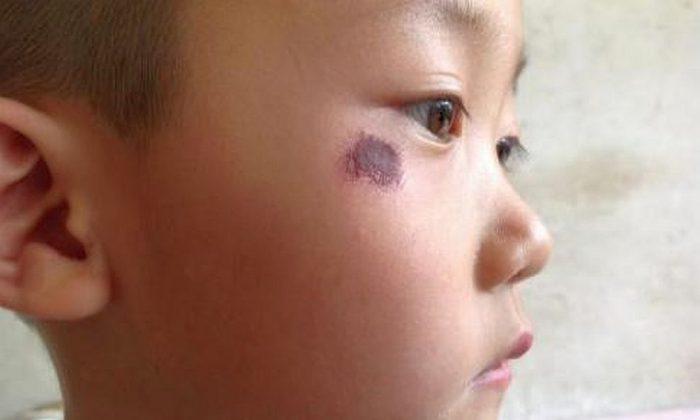 Report: 4-Year-Old Chinese Boy Clipped by Police Van During Mother’s Arrest