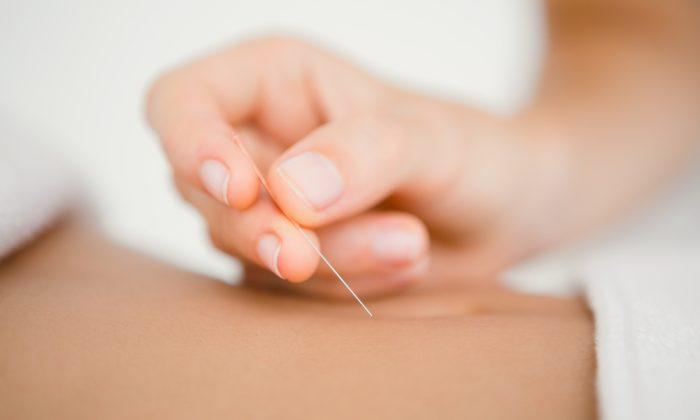 Acupuncture Beats Drug for Gastritis Relief