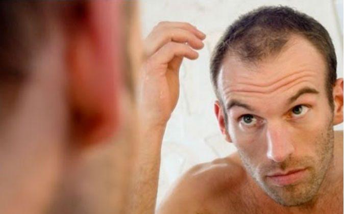7 Surprising Reasons You May Be Losing Hair