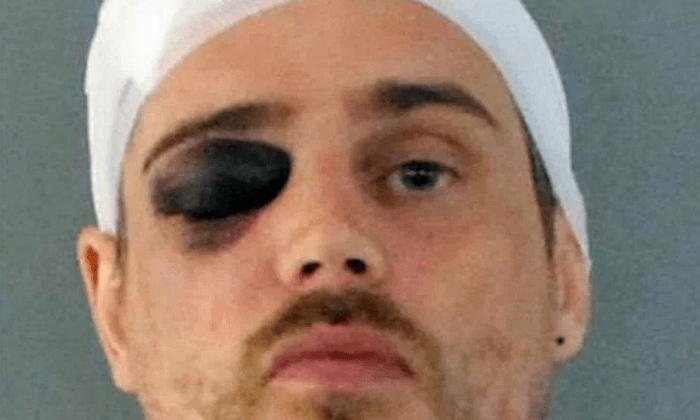 Man Invades Florida Home, Is Beaten With Bat