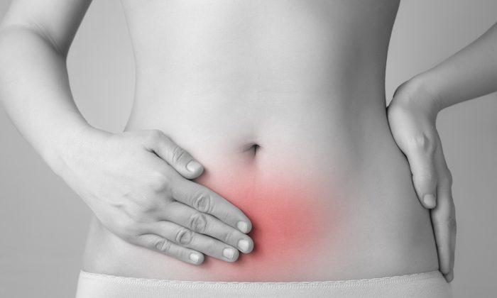 Endometriosis Raises Ovarian Cancer Risk