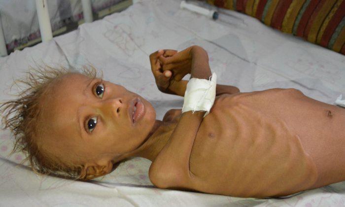 Ravaged by Conflict, Yemen’s Coast Faces Rising Malnutrition
