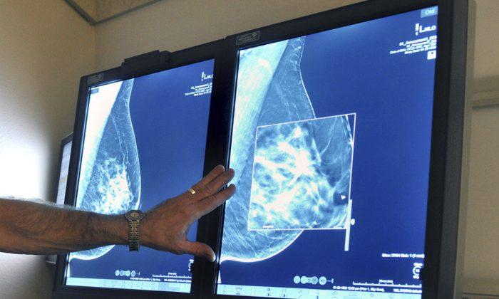 Experts Do Not Advise Routine Breast Cancer Screenings for Women Under 50