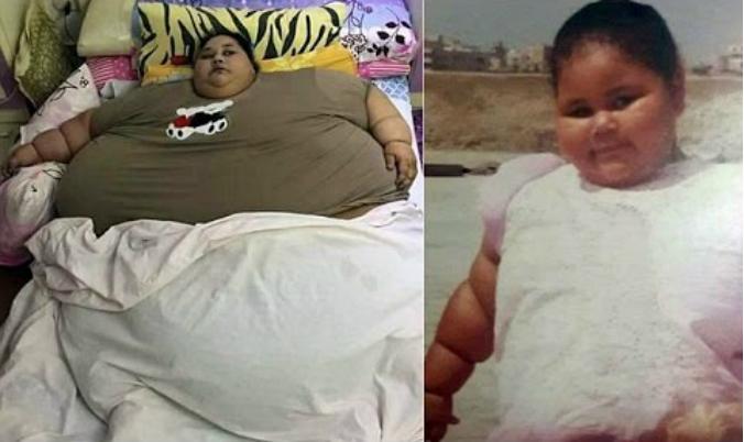 1,100-Pound Woman Leaves Egypt to India for Surgery