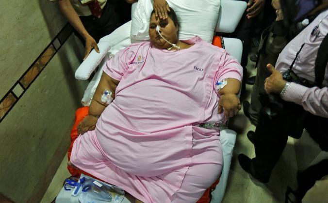 Egyptian Woman Leaves Indian Hospital More Than 300 kg Lighter