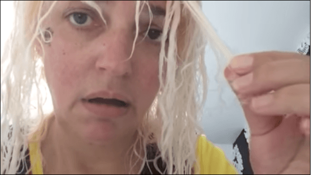 Woman Loses Hair After Hair Dye Job Goes Terribly Wrong