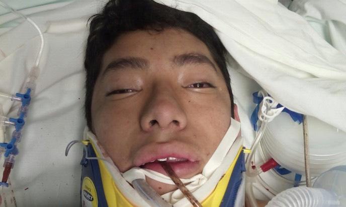 Teenager Crushed While Rescuing Others After Mexico Quake Remains in Coma