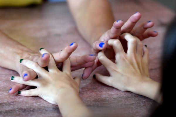 Silvia Santos da Silva and Maria Santos, who were both born with 12 fingers, join hands in their home in Brasilia, on June 21, 2014. (EVARISTO SA/AFP/Getty Images)