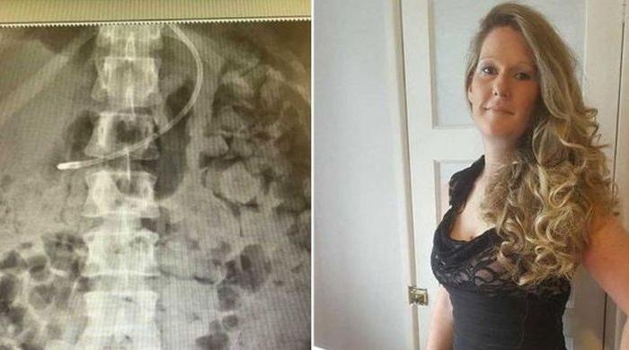 Woman ‘Suffocating’ From Own Waste After Routine Surgery
