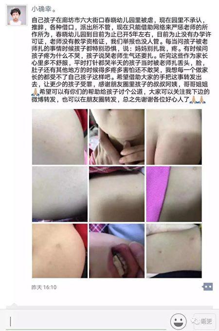 A parent's uploaded photo of needle marks on her child, who attends the Langfang City Chunxiao Kindergarten. (Screenshot via WeChat)