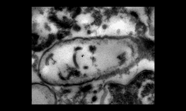 The macrosporidia parasite. (National Institute of Health)