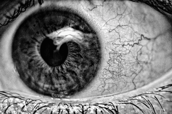 A close-up of a bloodshot human eye. (Luca Biada, CC BY 2.0)