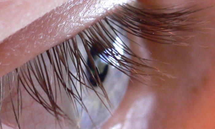 Woman Complained of ‘Itchy Eyes,' Then Doctors Make Unusual Find in Her Eyelashes