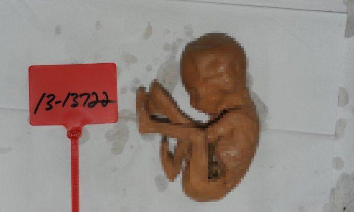 Exclusive: Federal Agents Found Fetuses in Body Broker’s Warehouse