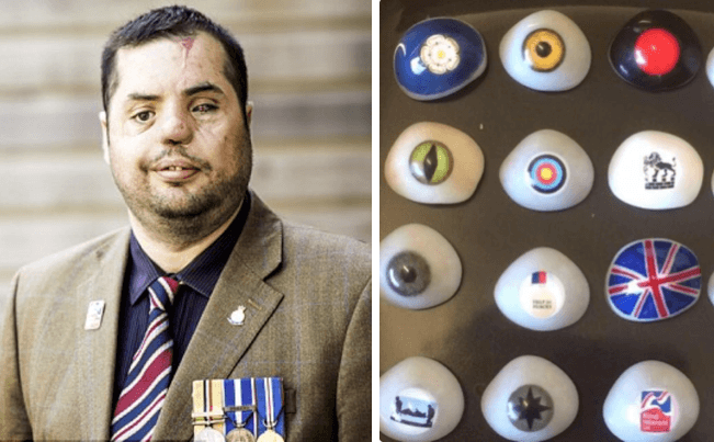 Ex-Soldier Who Lost Eye to Sniper in Iraq Has Lost Glass Eye Collection