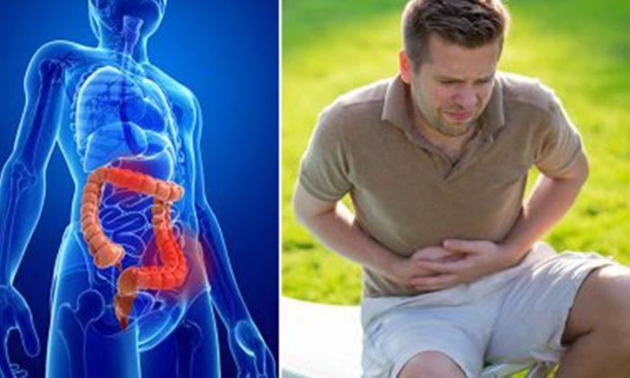 6 Warning Signs That Could Indicate Colorectal Cancer or a Tumor in Your Large Intestine