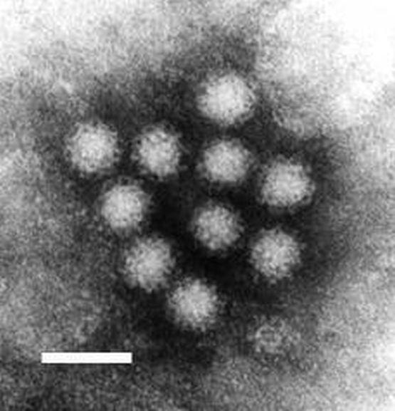 Norovirus (EPA.gov / Public Domain)